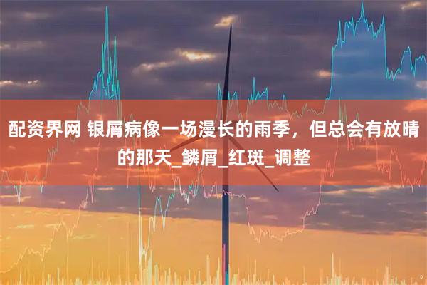 配资界网 银屑病像一场漫长的雨季，但总会有放晴的那天_鳞屑_红斑_调整